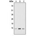 LifeSab™ RPS19BP1 Rabbit pAb (50 µl)