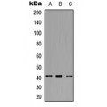 LifeSab™ SDCCAG8 Rabbit pAb (50 µl)