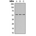 LifeSab™ SH2D4A Rabbit pAb (50 µl)