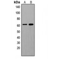 LifeSab™ SHCA (pY349) Rabbit pAb (50 µl)