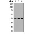 LifeSab™ TTF1 Rabbit pAb (50 µl)