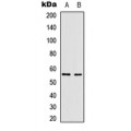 LifeSab™ Vimentin Rabbit pAb (50 µl)