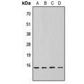 LifeSab™ 4EBP1 (pT69) Rabbit pAb (50 µl)