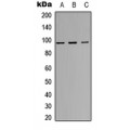 LifeSab™ Insulin Receptor (pY1355) Rabbit pAb (50 µl)