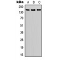 LifeSab™ ASK1 (pS966) Rabbit pAb (50 µl)