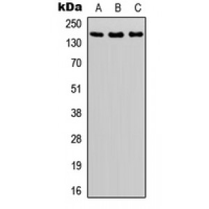 LifeSab™ ASK1 (pS966) Rabbit pAb (50 µl)
