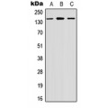 LifeSab™ MEKKK6 Rabbit pAb (50 µl)