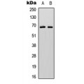 LifeSab™ PAK1/2/3 (pS144/141/139) Rabbit pAb (50 µl)
