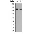 LifeSab™ PYK2 Rabbit pAb (50 µl)