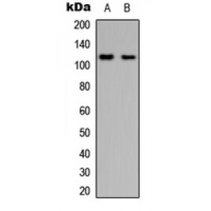 LifeSab™ PYK2 Rabbit pAb (50 µl)