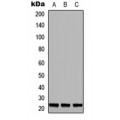 LifeSab™ ULK3 Rabbit pAb (50 µl)