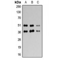 LifeSab™ Adenosine A3 Receptor Rabbit pAb (50 µl)
