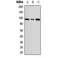 LifeSab™ c-FER (pY402) Rabbit pAb (50 µl)