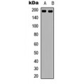LifeSab™ NMDAR2B Rabbit pAb (50 µl)
