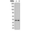 LifeSab™ MKK7 (pS271) Rabbit pAb (50 µl)