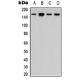 LifeSab™ ASK1 (pS83) Rabbit pAb (50 µl)
