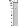 LifeSab™ TAK1 (pT184) Rabbit pAb (50 µl)