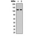 LifeSab™ PKC mu Rabbit pAb (50 µl)