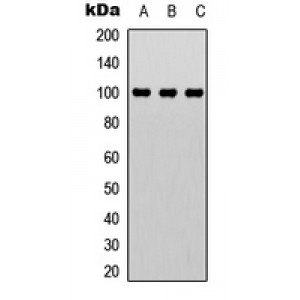 LifeSab™ CTIP Rabbit pAb (50 µl)