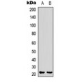 LifeSab™ RB3 Rabbit pAb (50 µl)