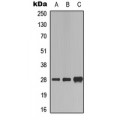 LifeSab™ FADD (pS194) Rabbit pAb (50 µl)
