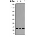 LifeSab™ ATF1 (pS63) Rabbit pAb (50 µl)