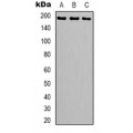 LifeSab™ Topoisomerase 2 alpha Rabbit pAb (50 µl)