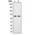 LifeSab™ DYRK1B Rabbit pAb (50 µl)