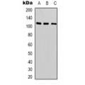 LifeSab™ SUPT16H Rabbit pAb (50 µl)