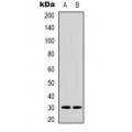 LifeSab™ ACBD6 Rabbit pAb (50 µl)