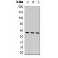 LifeSab™ SESN1 Rabbit pAb (50 µl)