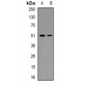 LifeSab™ MNK1 (pT250) Rabbit pAb (50 µl)