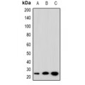 LifeSab™ SFT2D3 Rabbit pAb (50 µl)