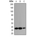 LifeSab™ ZNT2 Rabbit pAb (50 µl)
