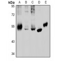 LifeSab™ GABRB2 Rabbit pAb (50 µl)