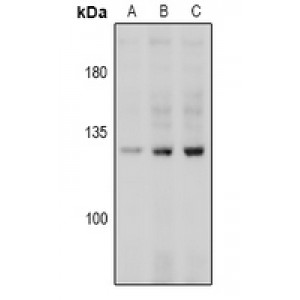 LifeSab™ CD144 (pY731) Rabbit pAb (50 µl)