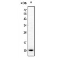 LifeSab™ CCL5 Rabbit pAb (50 µl)