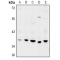 LifeSab™ GPRC5D Rabbit pAb (50 µl)