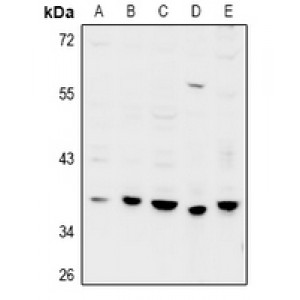 LifeSab™ GPRC5D Rabbit pAb (50 µl)