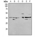 LifeSab™ OUTB1 Rabbit pAb (50 µl)