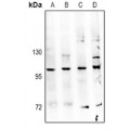 LifeSab™ TBK1 Rabbit pAb (50 µl)