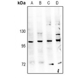 LifeSab™ TBK1 Rabbit pAb (50 µl)