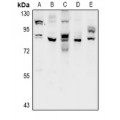 LifeSab™ CSGLCAT Rabbit pAb (50 µl)