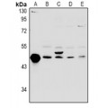 LifeSab™ FKBPL Rabbit pAb (50 µl)