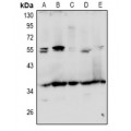 LifeSab™ GRTP1 Rabbit pAb (50 µl)