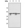 LifeSab™ p46 Rabbit pAb (50 µl)