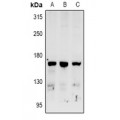 LifeSab™ RAB3GAP2 Rabbit pAb (50 µl)