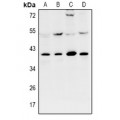 LifeSab™ KPC2 Rabbit pAb (50 µl)