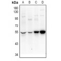 LifeSab™ UEVLD Rabbit pAb (50 µl)