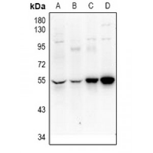 LifeSab™ UEVLD Rabbit pAb (50 µl)